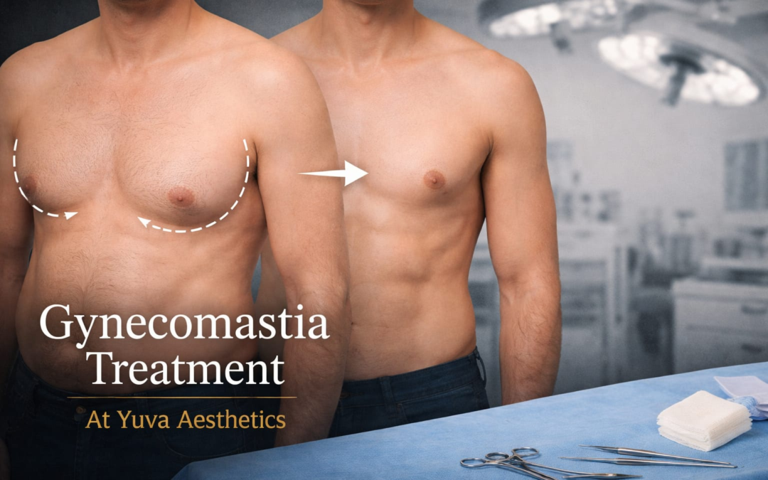 Gynecomastia Treatment at Yuva Aesthetics